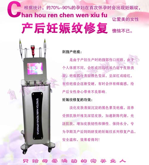 自信媽咪產(chǎn)后妊娠紋修復