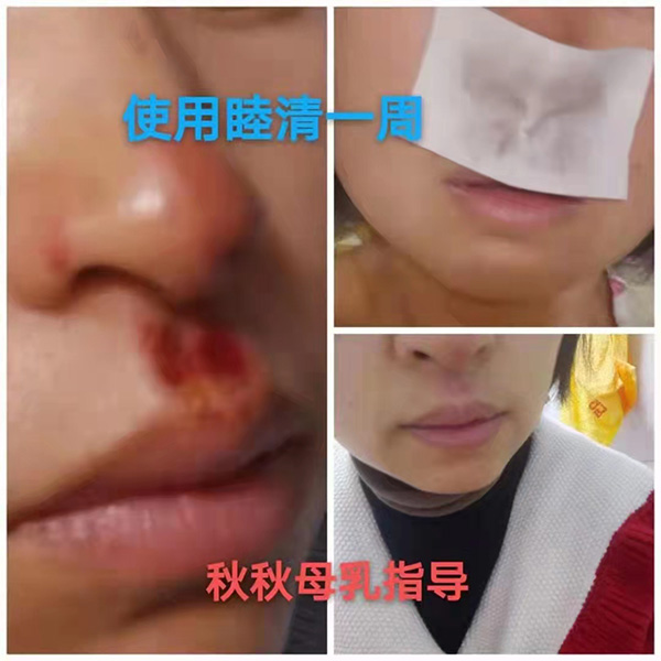 �����澏���N���Æ������M(f��i)�߿ڱ���������(sh��)���a(ch��n)ƷȦ�۟o��(sh��)